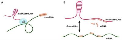 Long Non-coding RNA MALAT1: A Key Player in Liver Diseases